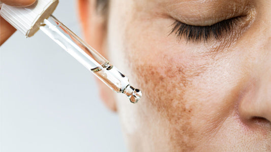 Desvelando los secretos del Ácido Tranexámico: Beneficios y usos en el cuidado de tu piel